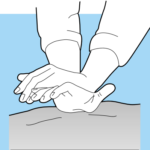 CPR6